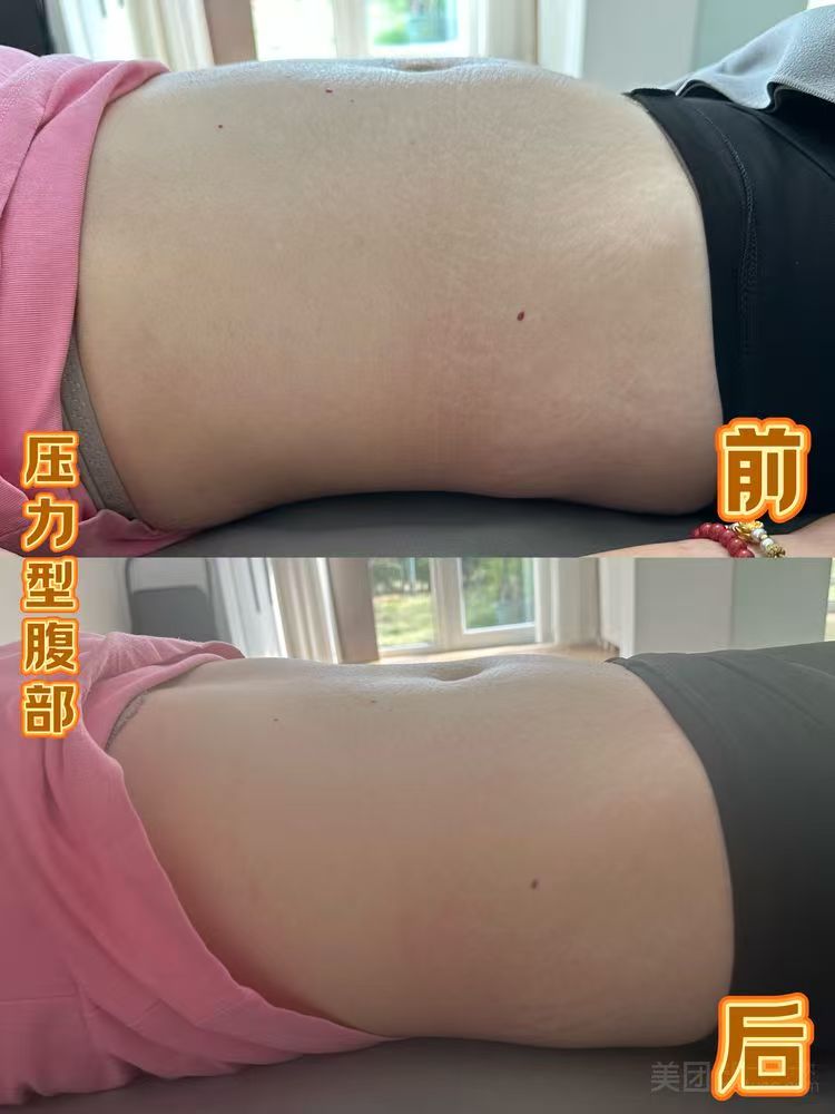 效果展示